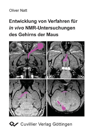 Entwicklung von Verfahren für in vivo NMR-Untersuchungen des Gehirns der Maus